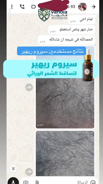 لقطة شاشة واتساب من تجربة عميل رقم 25
