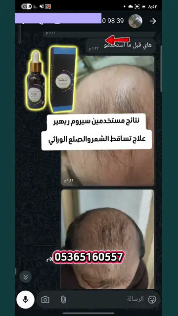 لقطة شاشة واتساب من تجربة عميل رقم 50