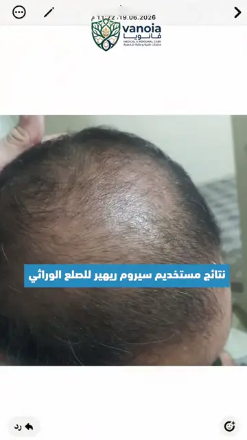 لقطة شاشة واتساب من تجربة عميل رقم 16