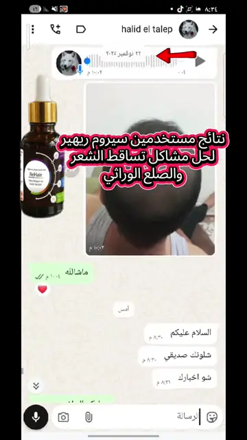 لقطة شاشة واتساب من تجربة عميل رقم 2