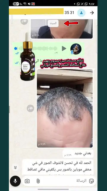 لقطة شاشة واتساب من تجربة عميل رقم 49