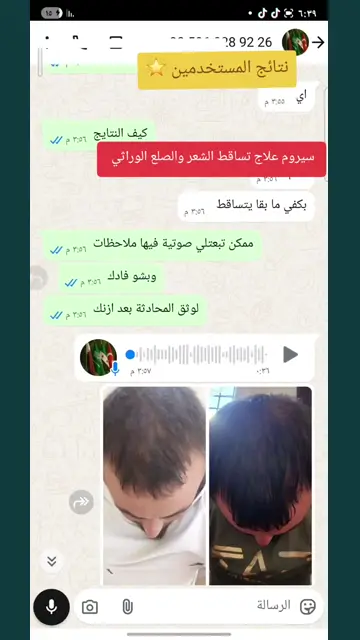 لقطة شاشة واتساب من تجربة عميل رقم 14