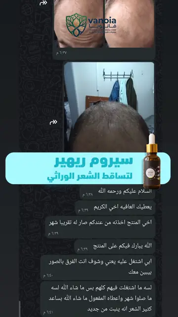 لقطة شاشة واتساب من تجربة عميل رقم 20