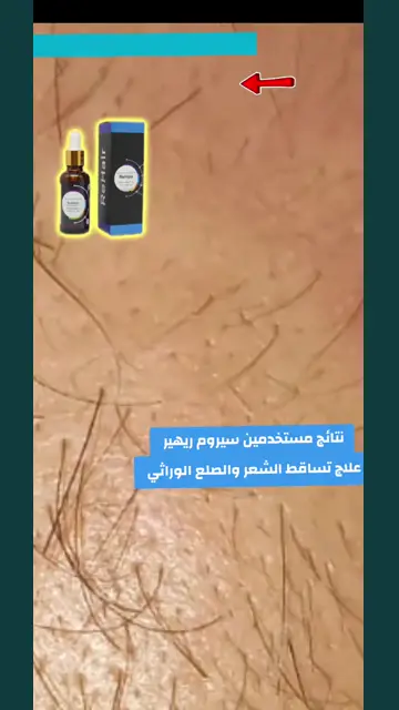 لقطة شاشة واتساب من تجربة عميل رقم 29