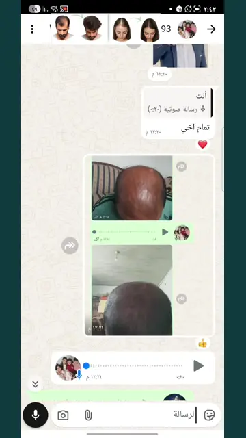 لقطة شاشة واتساب من تجربة عميل رقم 11