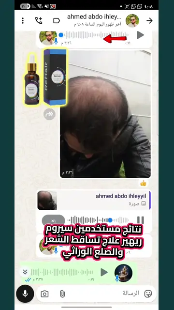 لقطة شاشة واتساب من تجربة عميل رقم 6
