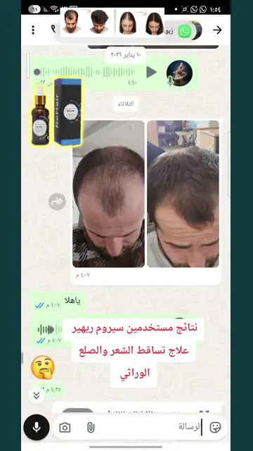 لقطة شاشة واتساب من تجربة عميل رقم 35