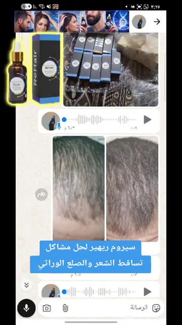 لقطة شاشة واتساب من تجربة عميل رقم 15