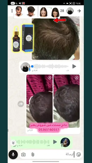 لقطة شاشة واتساب من تجربة عميل رقم 39