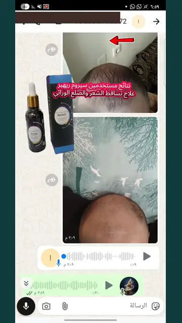 لقطة شاشة واتساب من تجربة عميل رقم 30