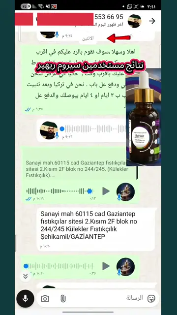 لقطة شاشة واتساب من تجربة عميل رقم 31