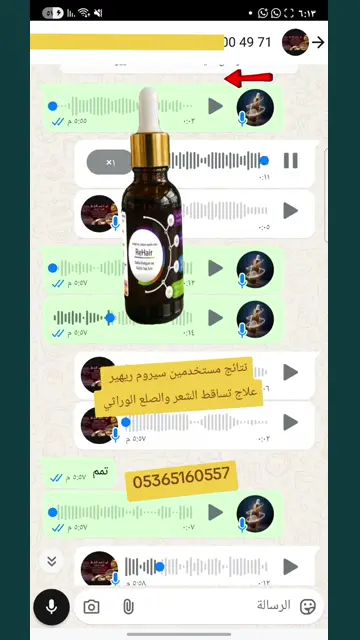 لقطة شاشة واتساب من تجربة عميل رقم 34