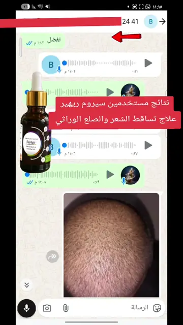 لقطة شاشة واتساب من تجربة عميل رقم 28