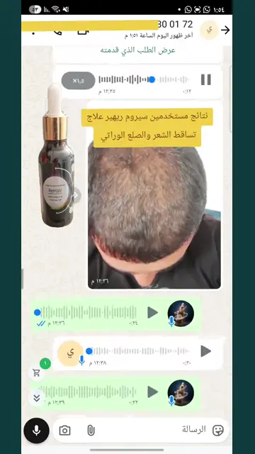 لقطة شاشة واتساب من تجربة عميل رقم 3