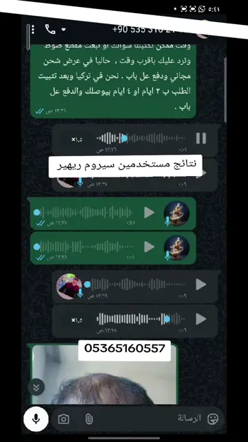 لقطة شاشة واتساب من تجربة عميل رقم 54