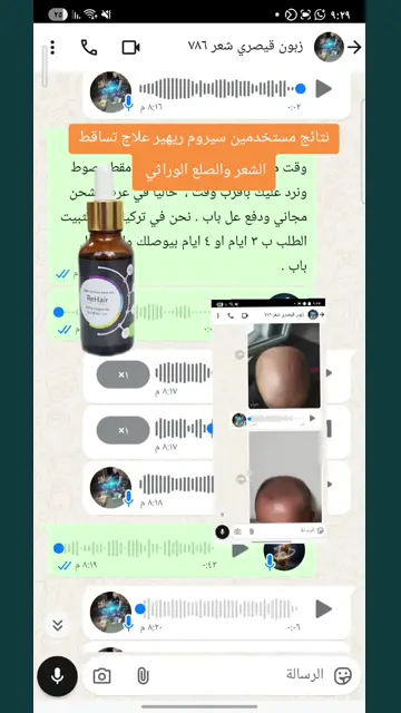 لقطة شاشة واتساب من تجربة عميل رقم 60